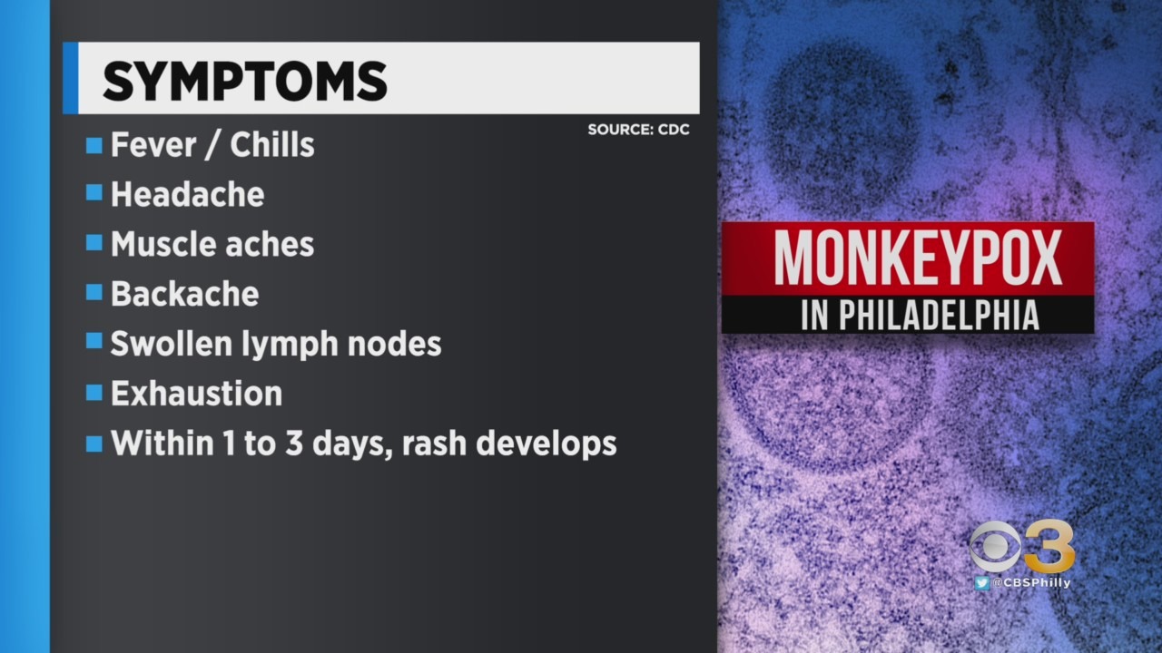 Penduduk Philadelphia Diidentifikasi Sebagai Kasus Cacar Monyet Kemungkinan Pertama di Pennsylvania, Kata Pejabat Kesehatan – CBS Philly